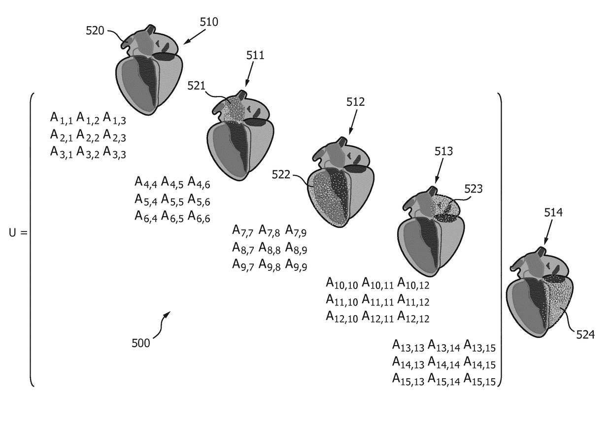 Model-based segmentation of an anatomical structure