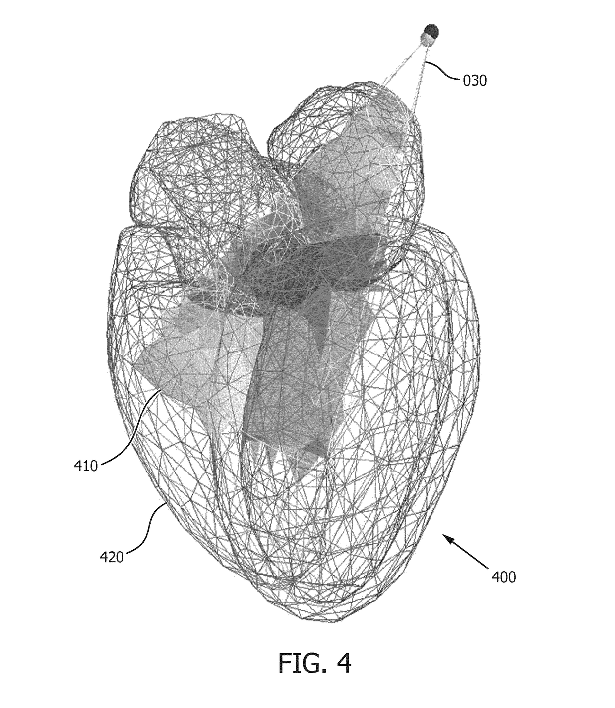 Model-based segmentation of an anatomical structure