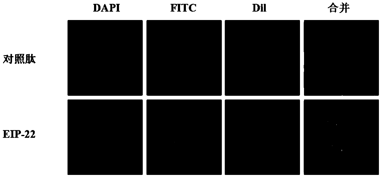 A kind of polypeptide eip-22 that can antagonize the rna binding activity of ewsr1 protein and its application