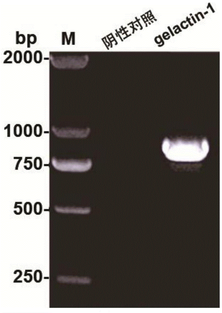 Method for expressing soluble angiostrongylus cantonensis galectin-1 protein by using pCold carrier