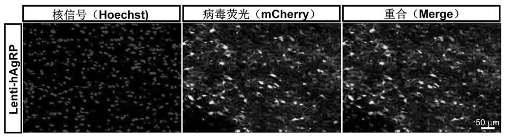 Vectors and reagent for constructing hNPY gene overexpression chimeric animal model and application