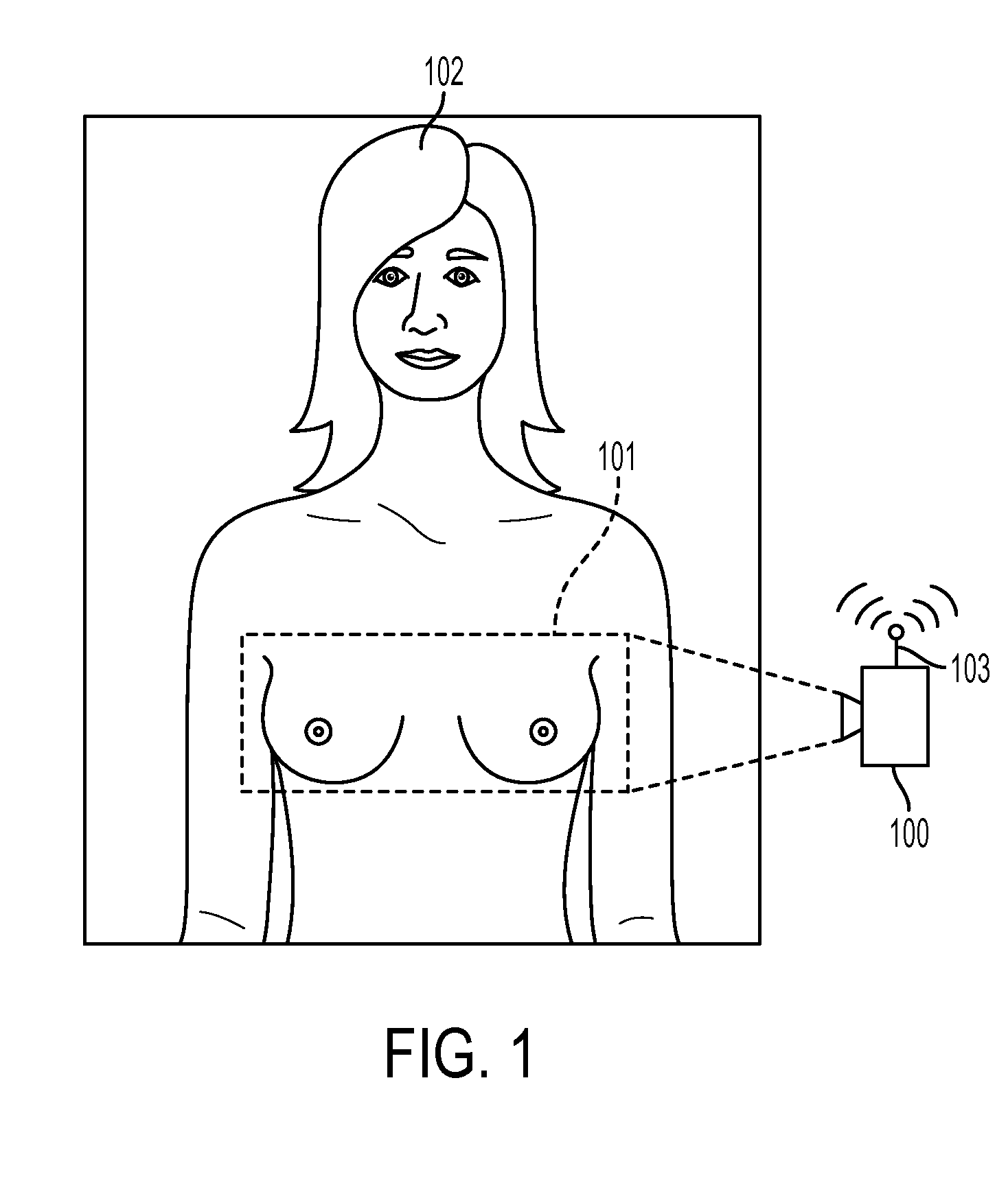 Detecting tumorous breast tissue in a thermal image