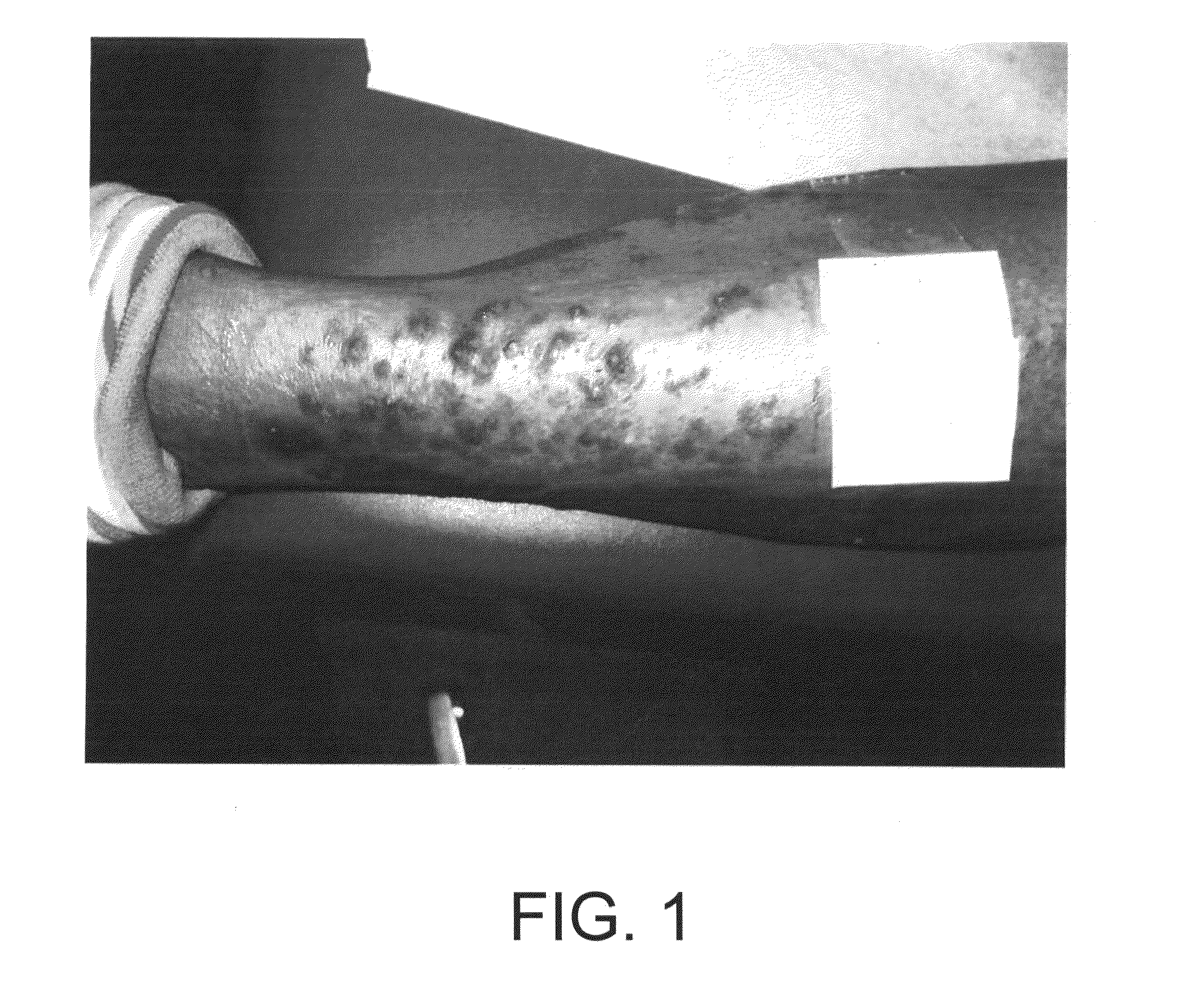 Method of treating acquired perforating dermatosis with cantharidin