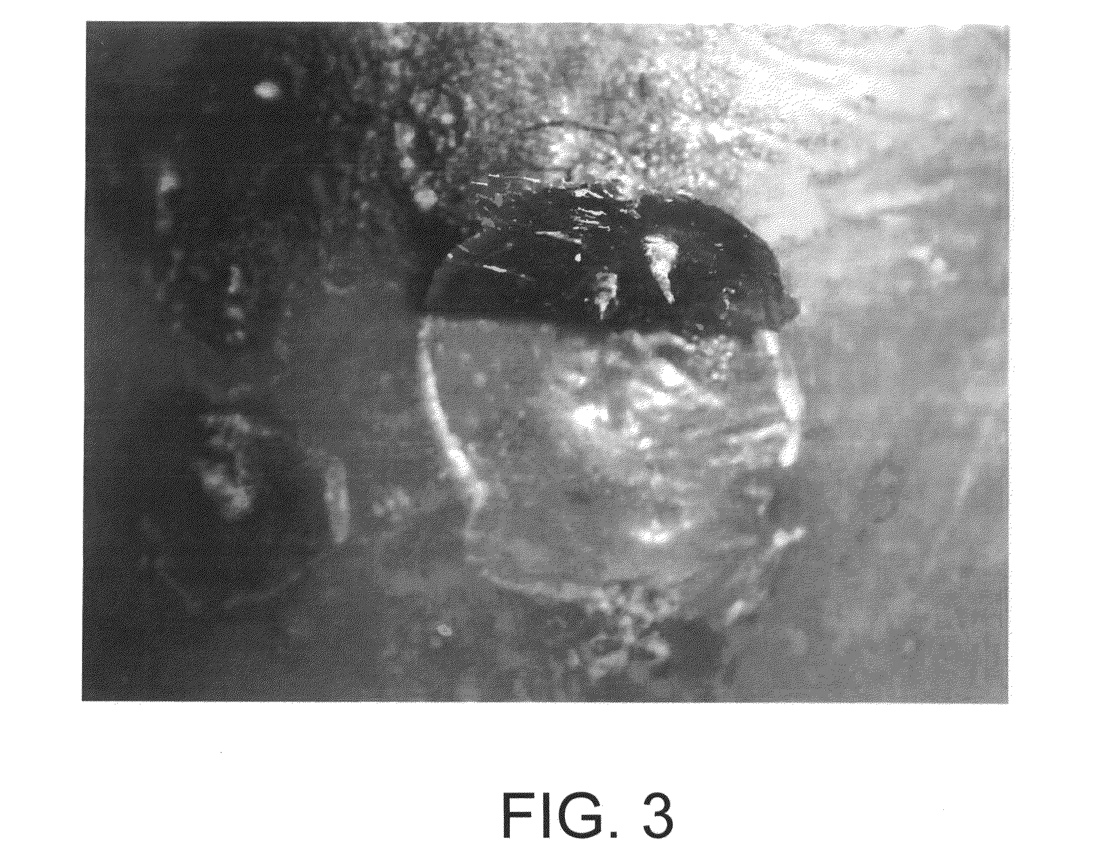 Method of treating acquired perforating dermatosis with cantharidin
