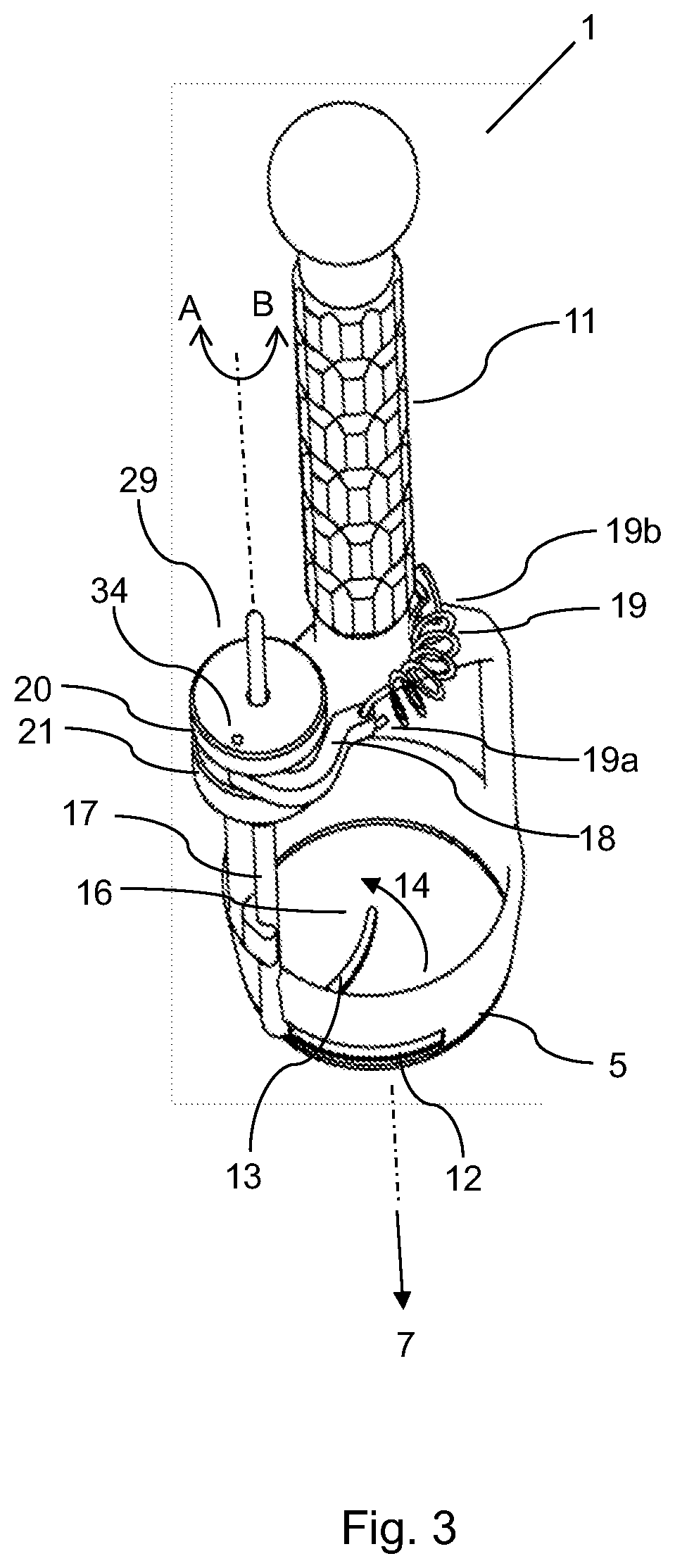 Surgical cutting apparatus for removal of a tumour from human tissue
