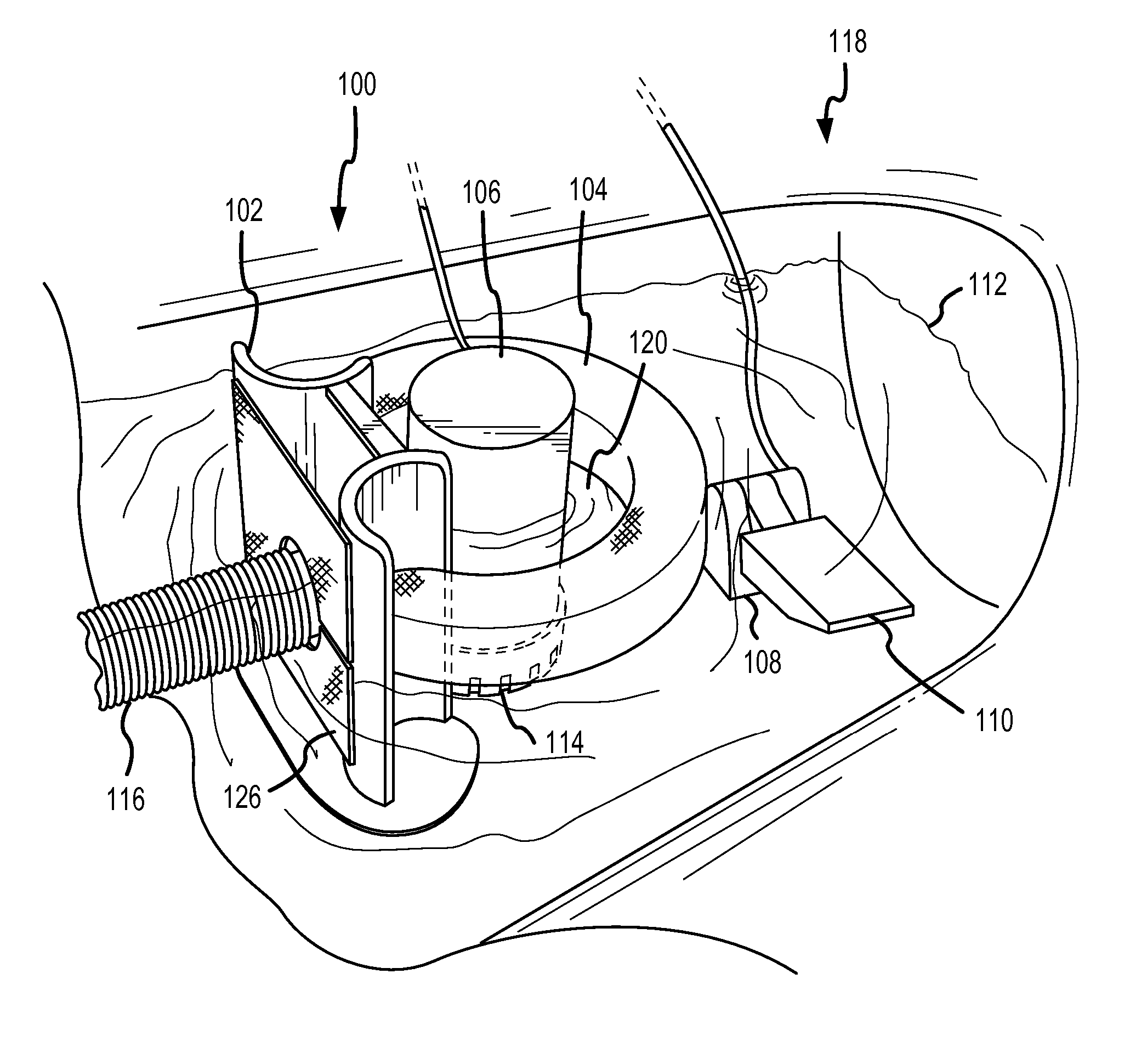 Water pollution prevention and remediation method