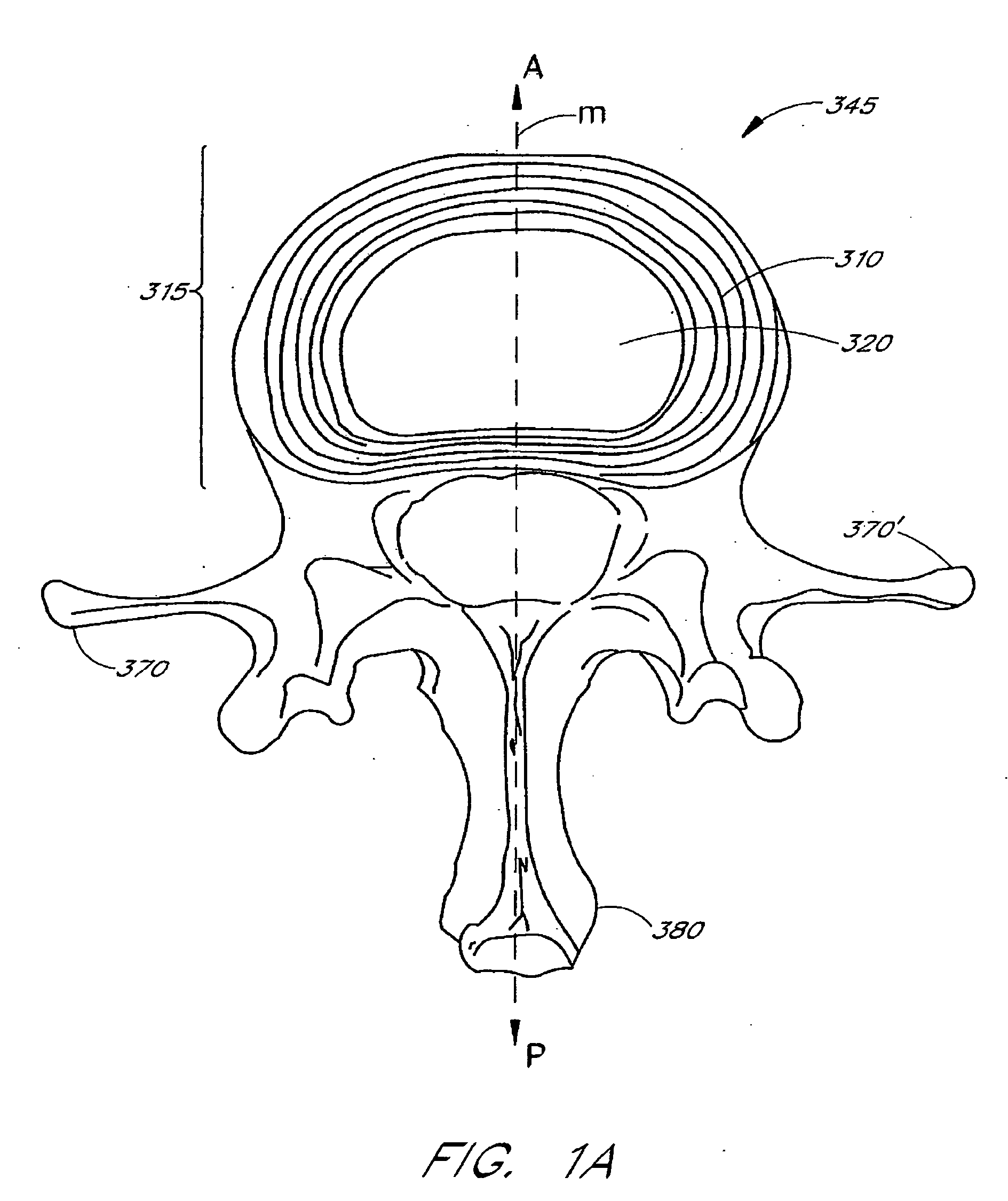 Method of performing a procedure within a disc