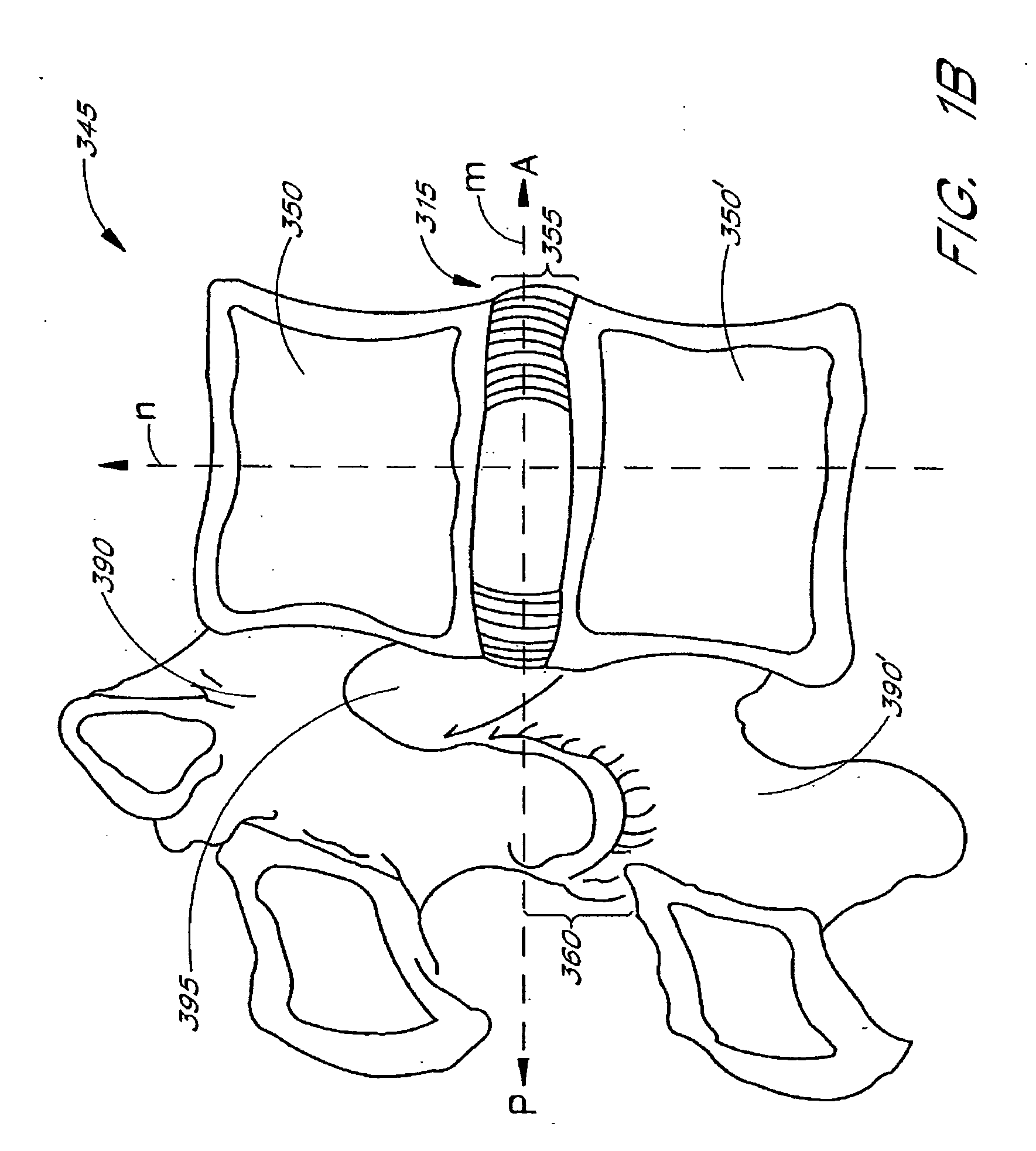 Method of performing a procedure within a disc