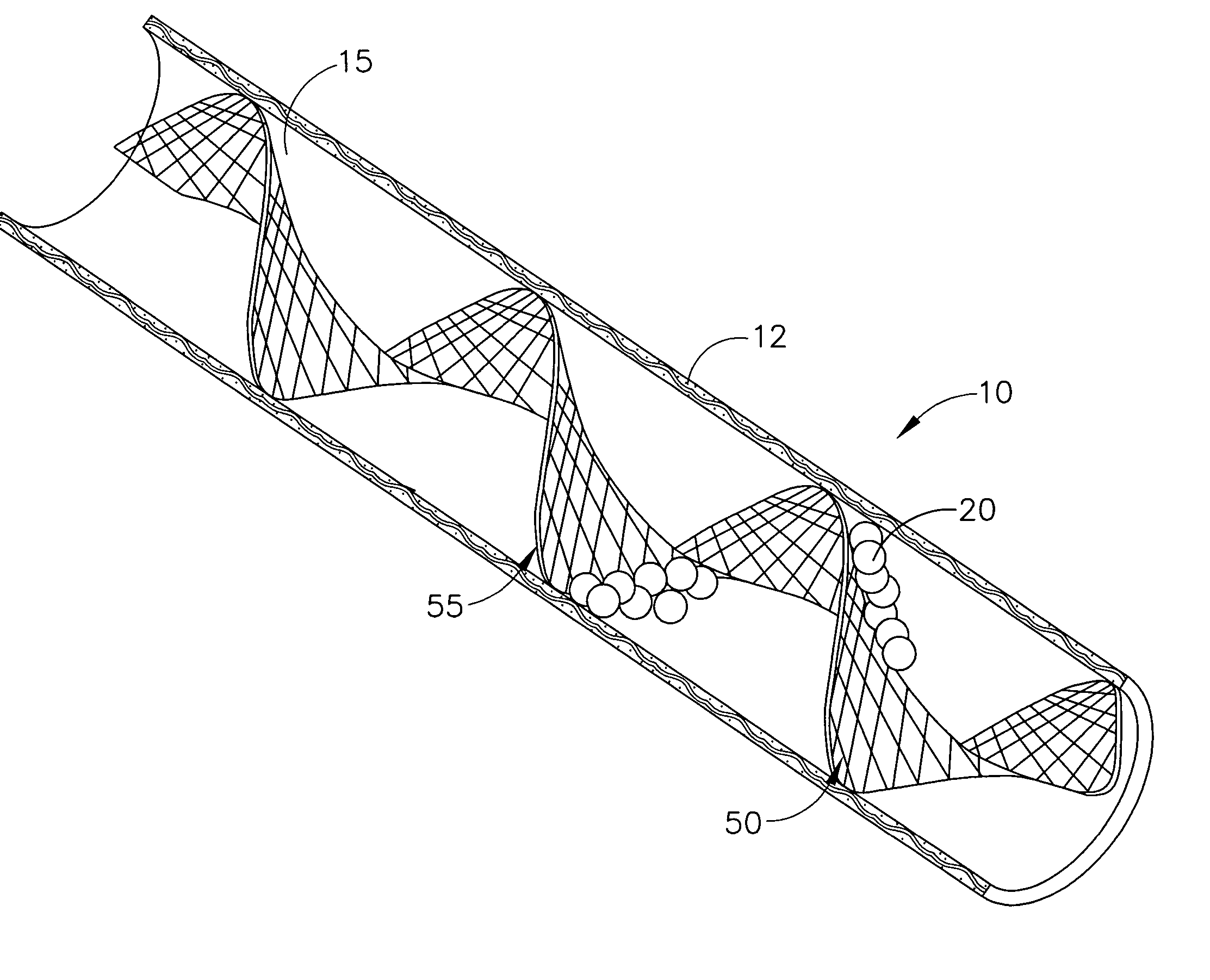 Device for filtering blood in a vessel with helical elements