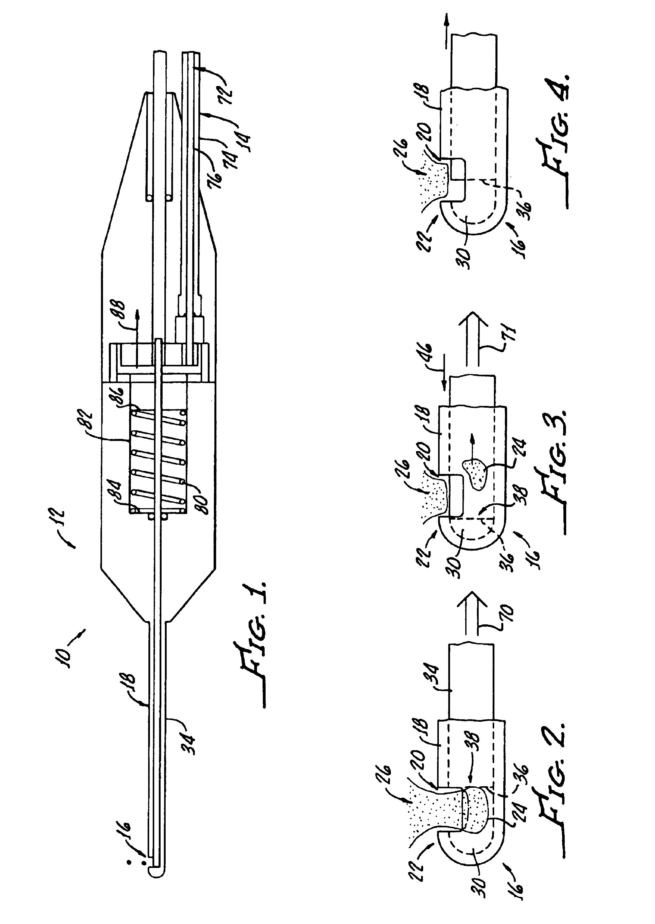 Pulsed vacuum and/or flow method and apparatus for tissue removal