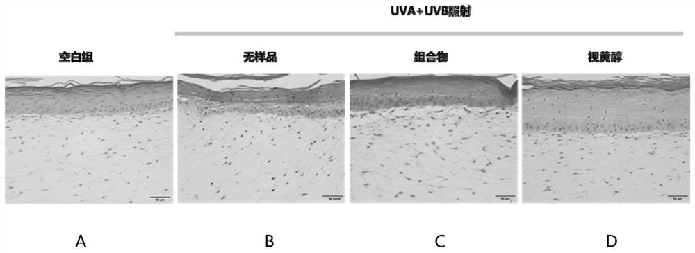 Anti-aging composition for increasing dermal collagen protein mass and maintaining fibroblast morphology and application of anti-aging composition