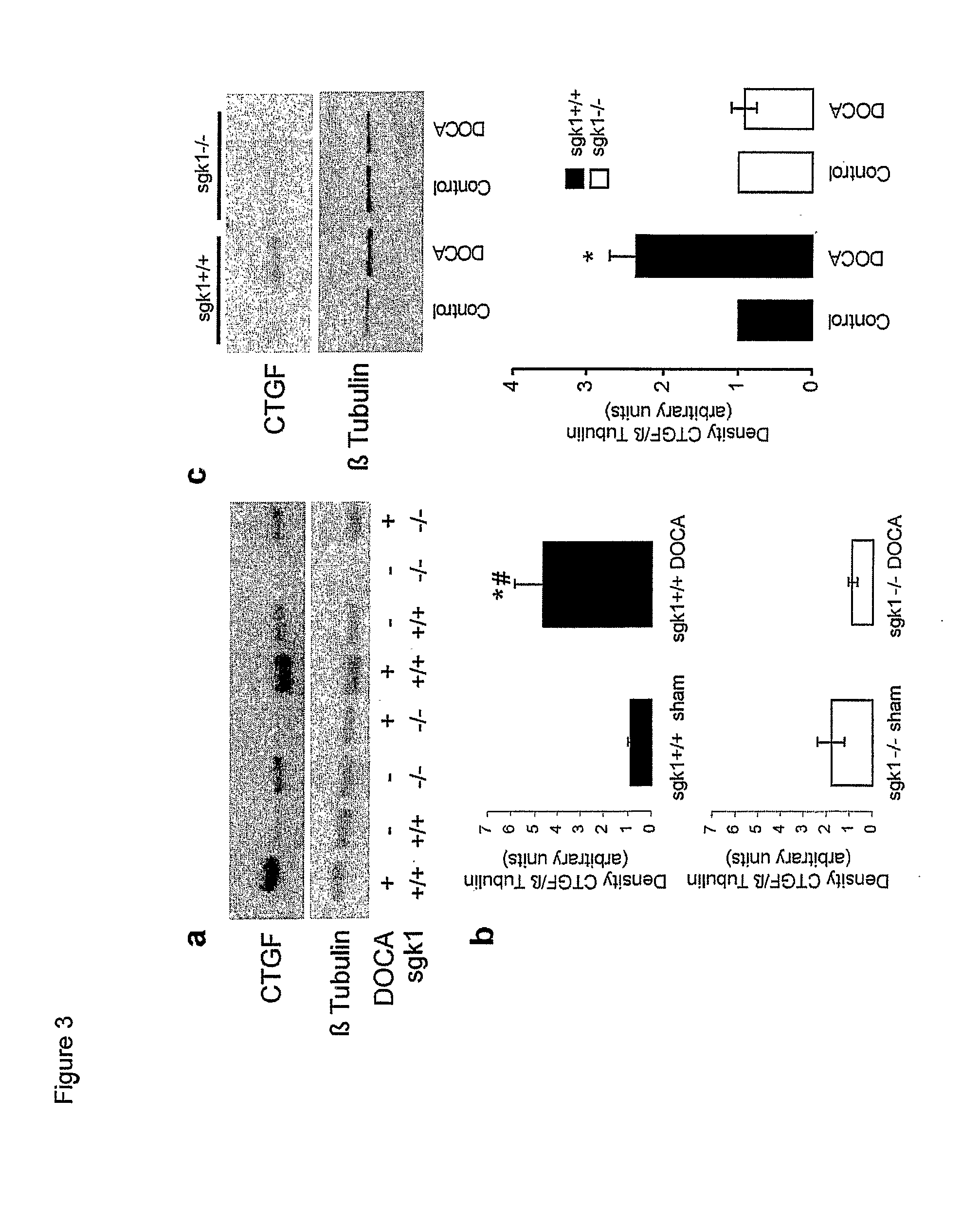 Methods For Interfering With Fibrosis