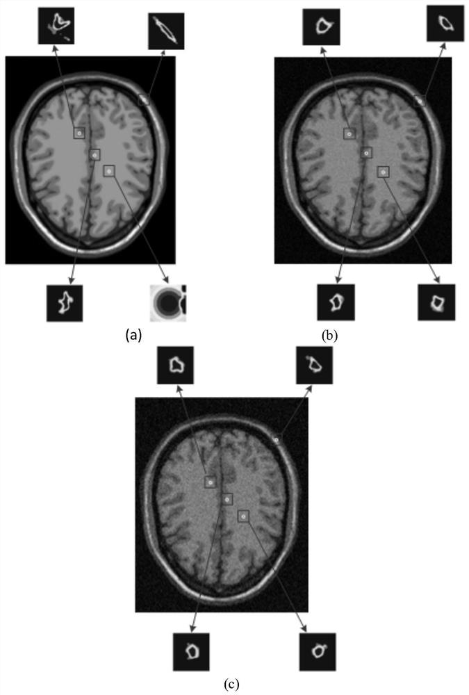 Medical MRI image up-sampling method based on adaptive local steering kernel