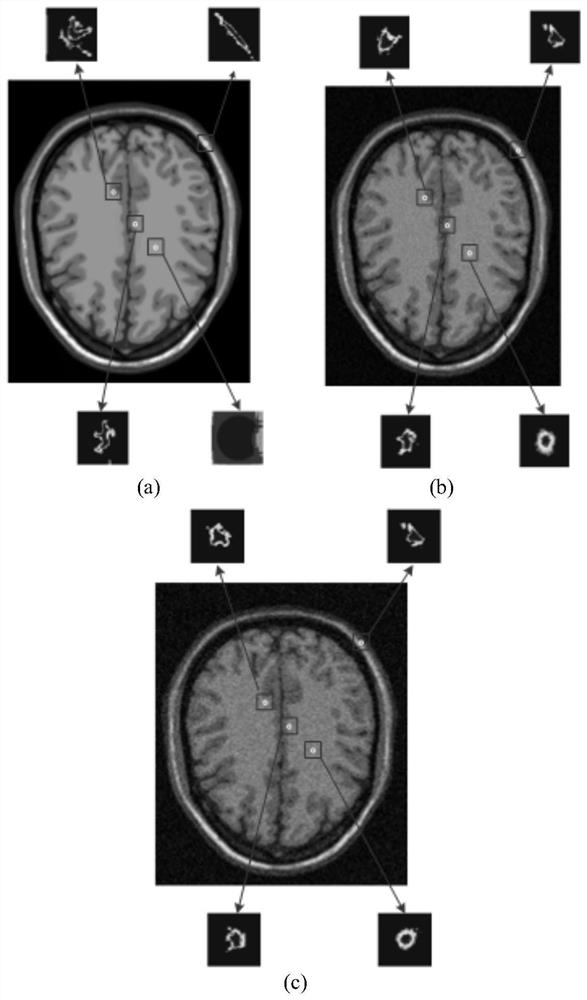 Medical MRI image up-sampling method based on adaptive local steering kernel