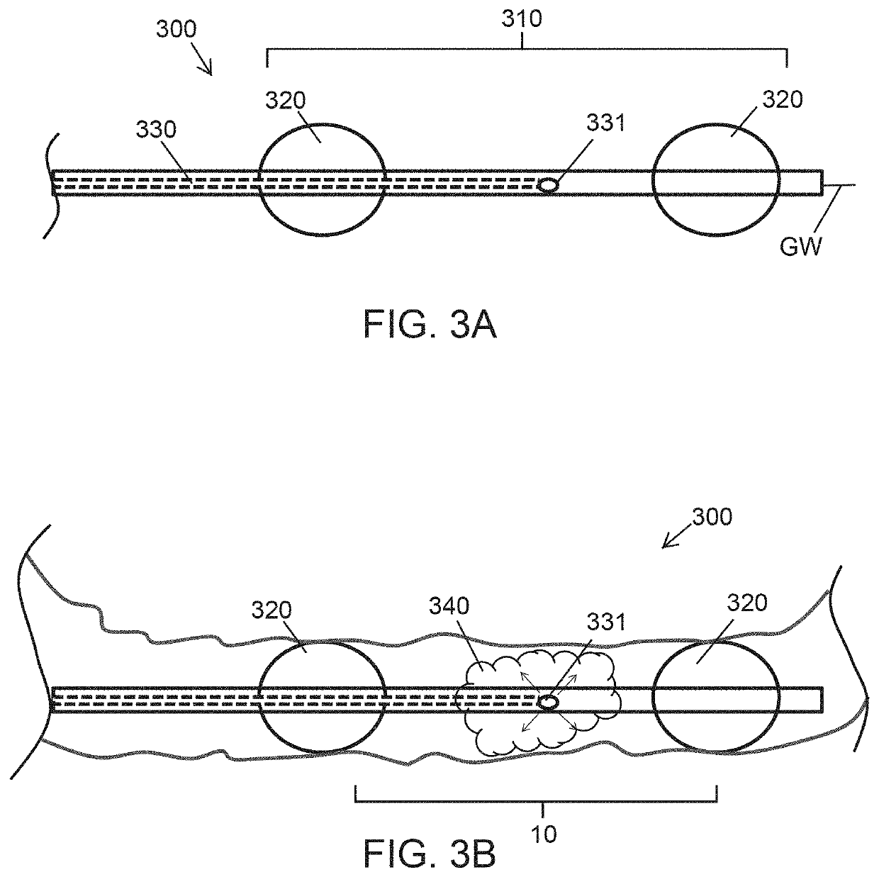 Diabetes Treatment Methods and Devices