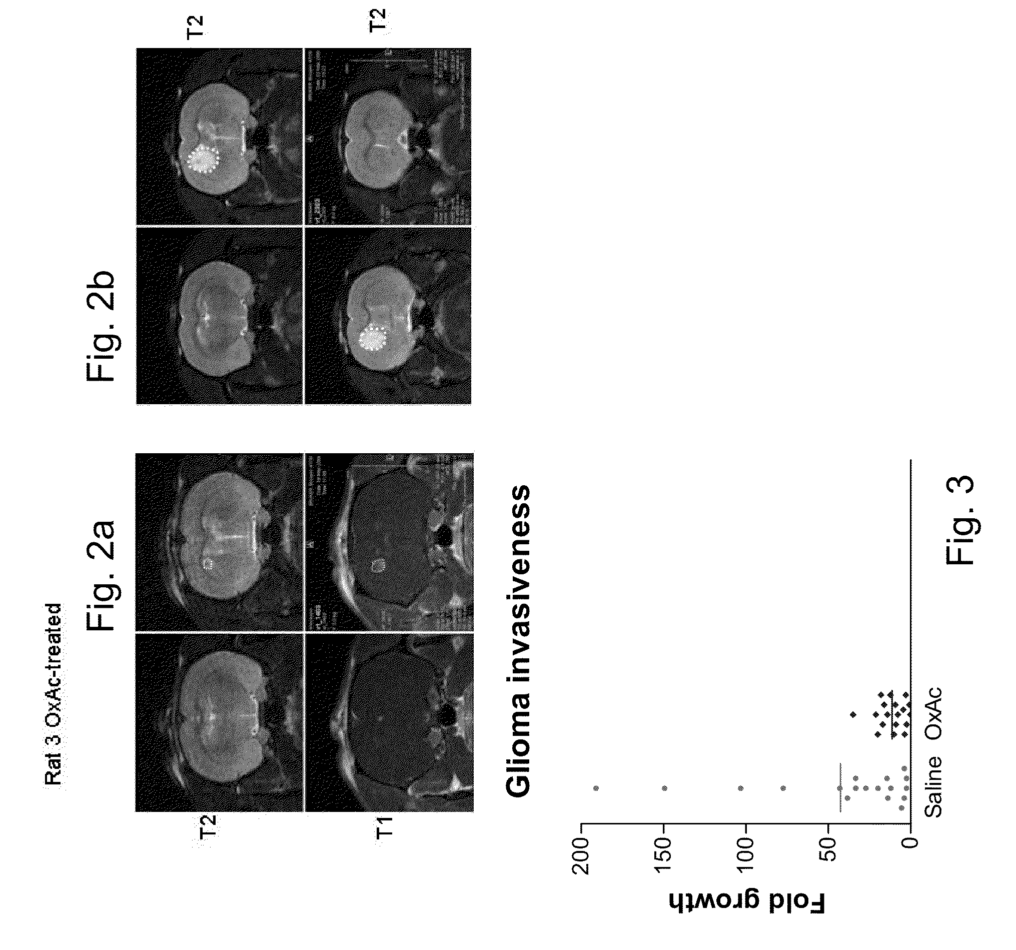 Methods of treating cancer of the central nervous system