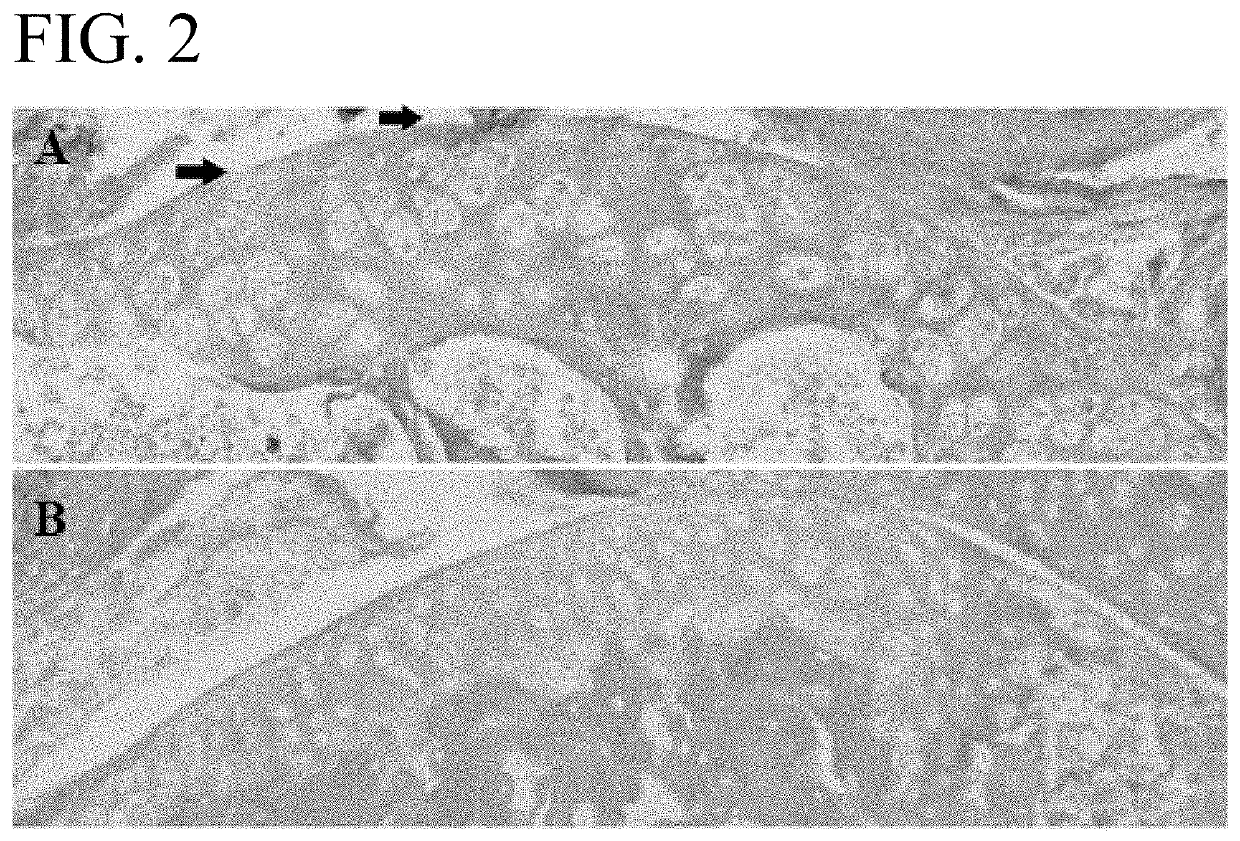 Compositions and Methods for Treating Pain with Wogonin