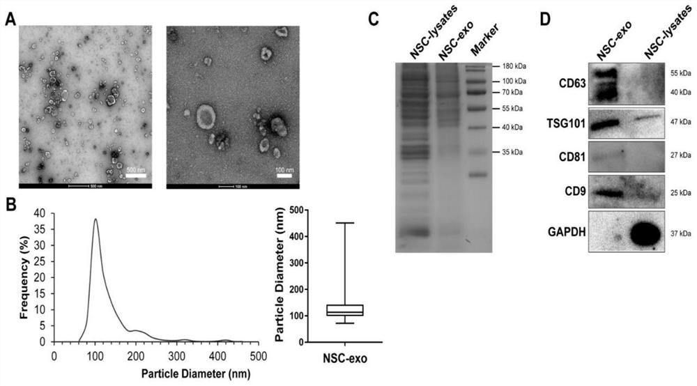 Exosome/honey compounded drug-loaded sustained-release microspheres and preparation method thereof