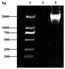 Acetyl CoA synthetase gene RKACS1 and application thereof