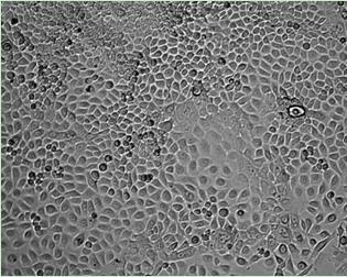 Cornea-like epithelioid cell, tissue-engineered corneal epithelium as well as preparation and application
