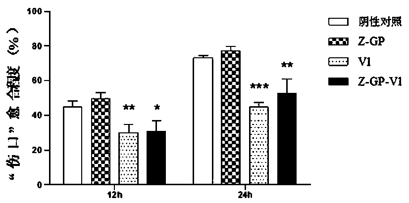 An anti-angiogenic peptide z-gp-v1 targeting FAP and its application