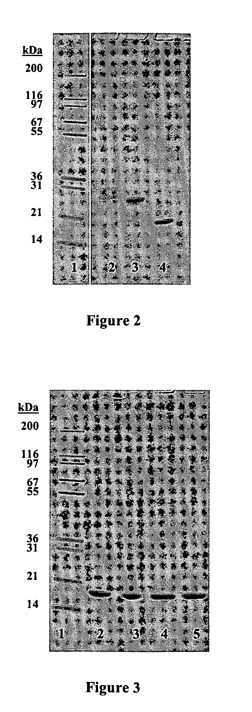Ricin vaccine and methods of making and using thereof