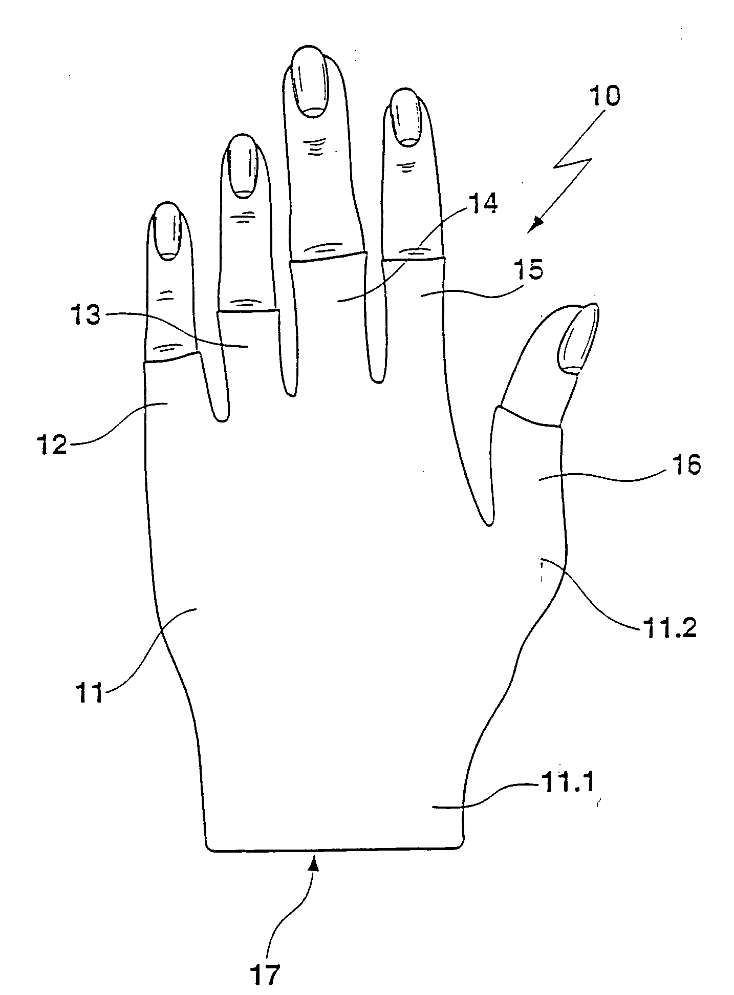 Knitted garment for the support and/or compression and/or compression therapy of parts of the body
