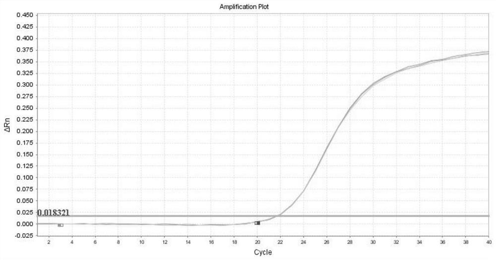 Human histamine receptor HRH1 mRNA detection primer probe set, kit and application