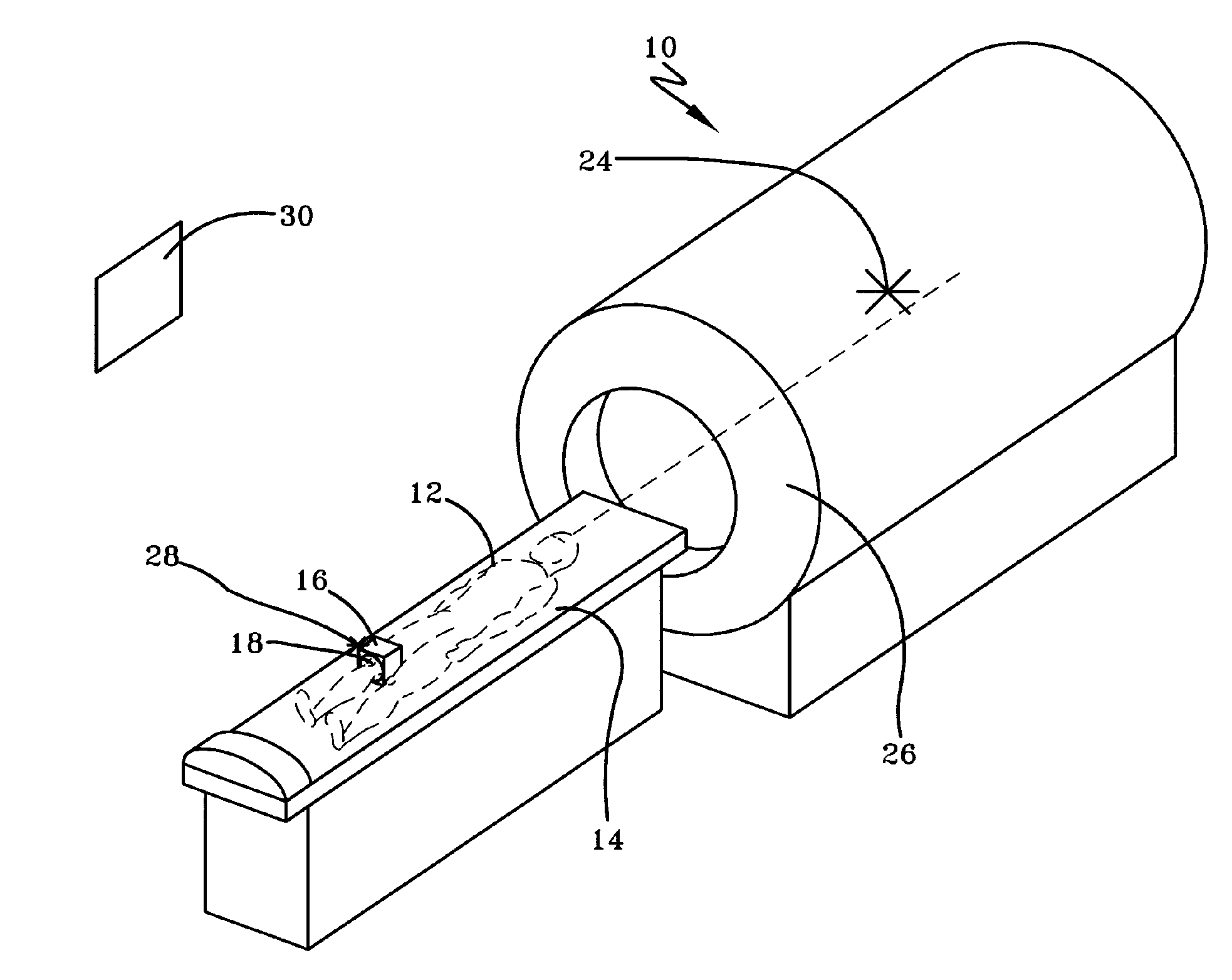 Automated Patient Localization in a Medical Imaging System