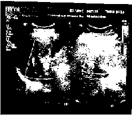 Traditional Chinese medicament composition and tablets for preventing and treating hepatic cirrhosis and preparation method for traditional Chinese medicament composition