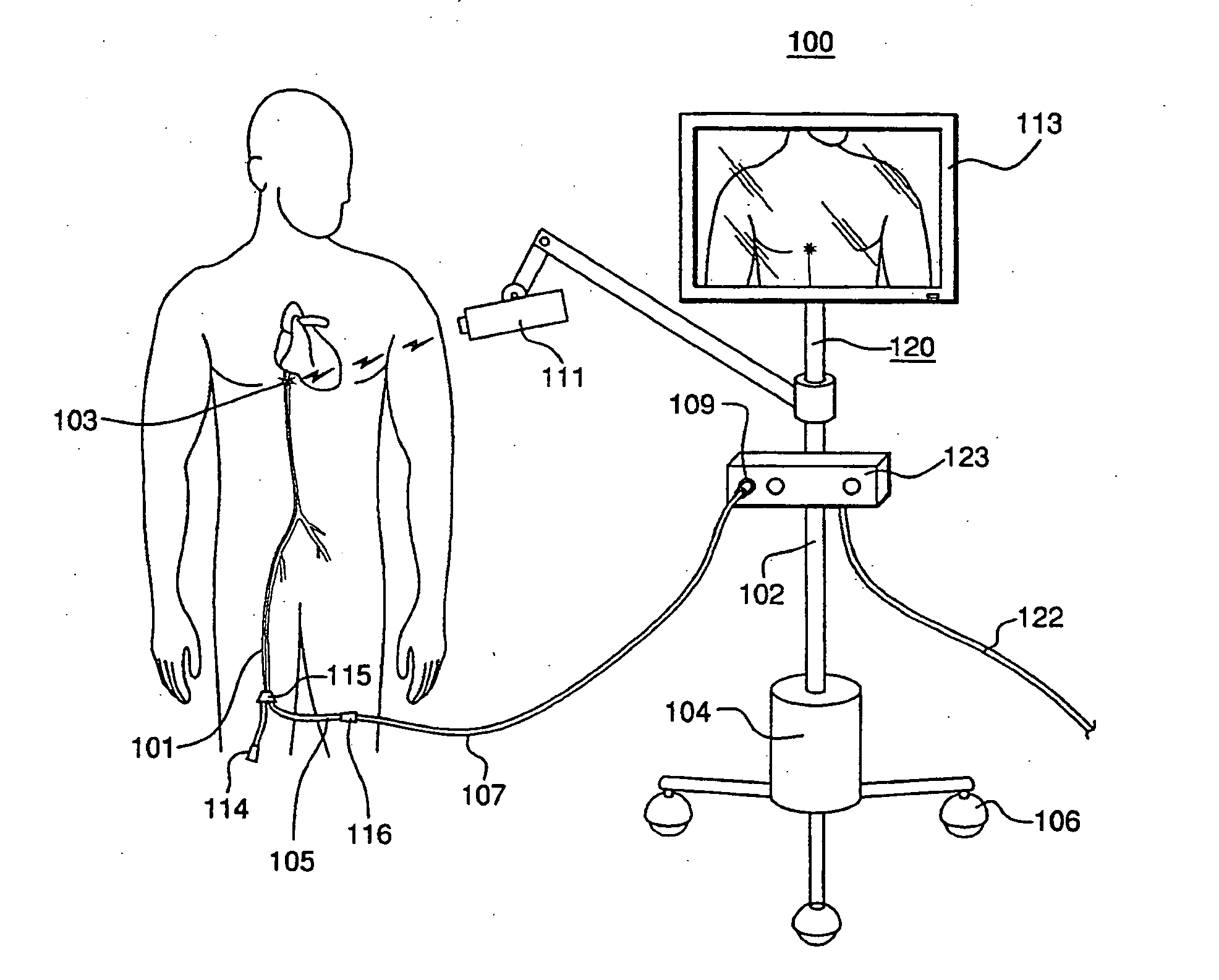 Three-dimensional optical guidance for catheter placement