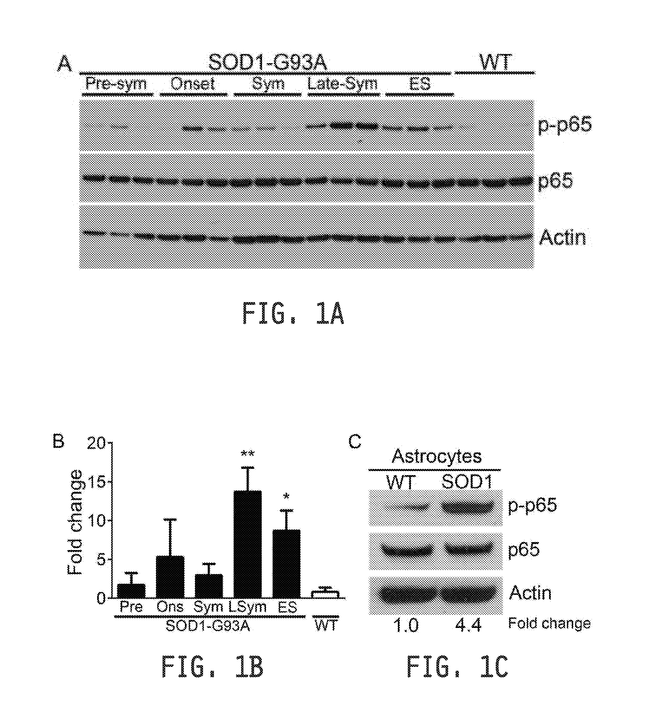 COMPOSITIONS AND METHODS FOR INHIBITING NF- kB AND SOD-1 TO TREAT AMYOTROPHIC LATERAL SCLEROSIS