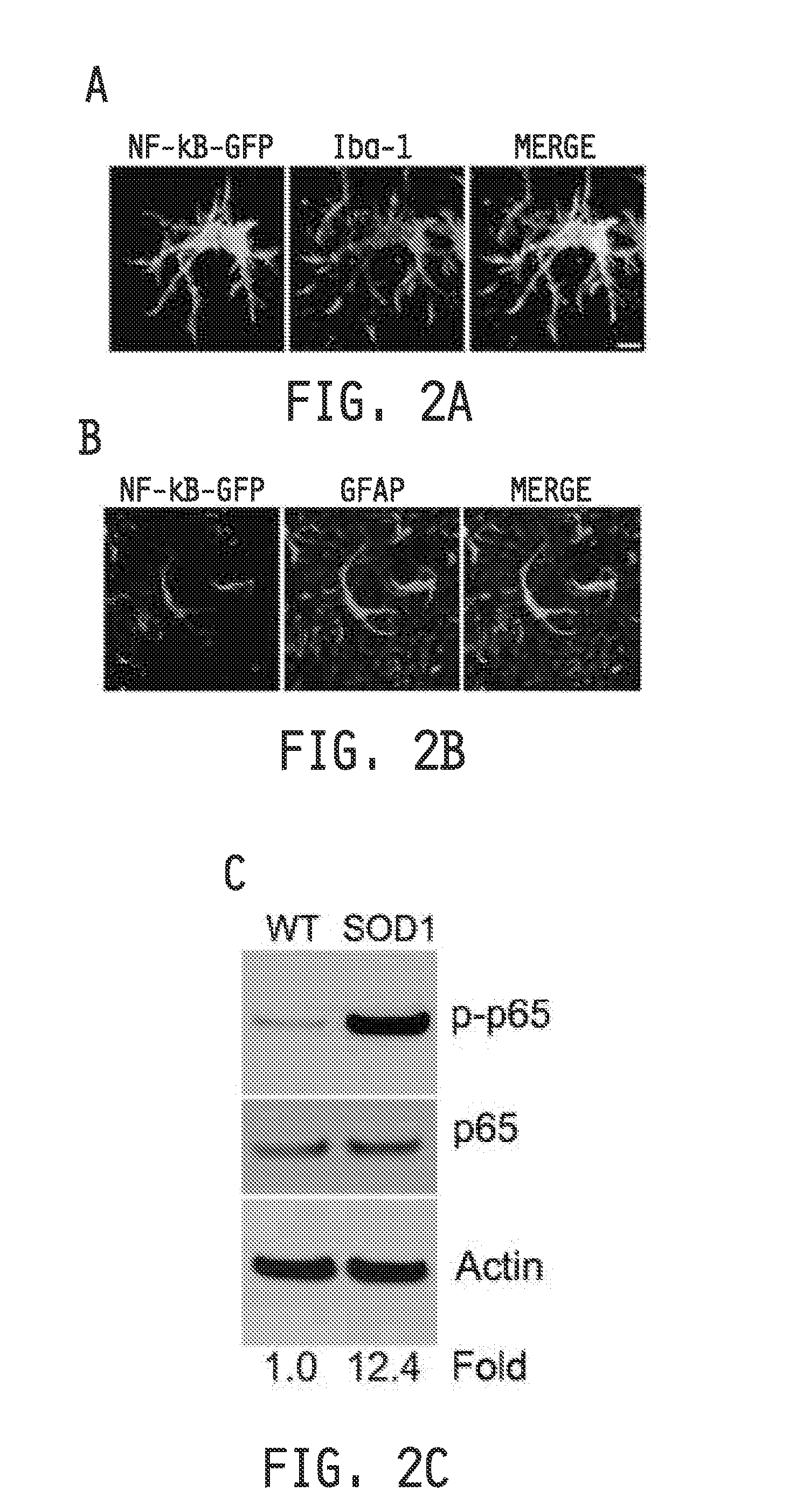 COMPOSITIONS AND METHODS FOR INHIBITING NF- kB AND SOD-1 TO TREAT AMYOTROPHIC LATERAL SCLEROSIS