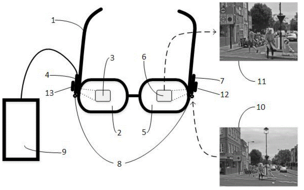 Head wearing type vision auxiliary system for patients with vision disorder