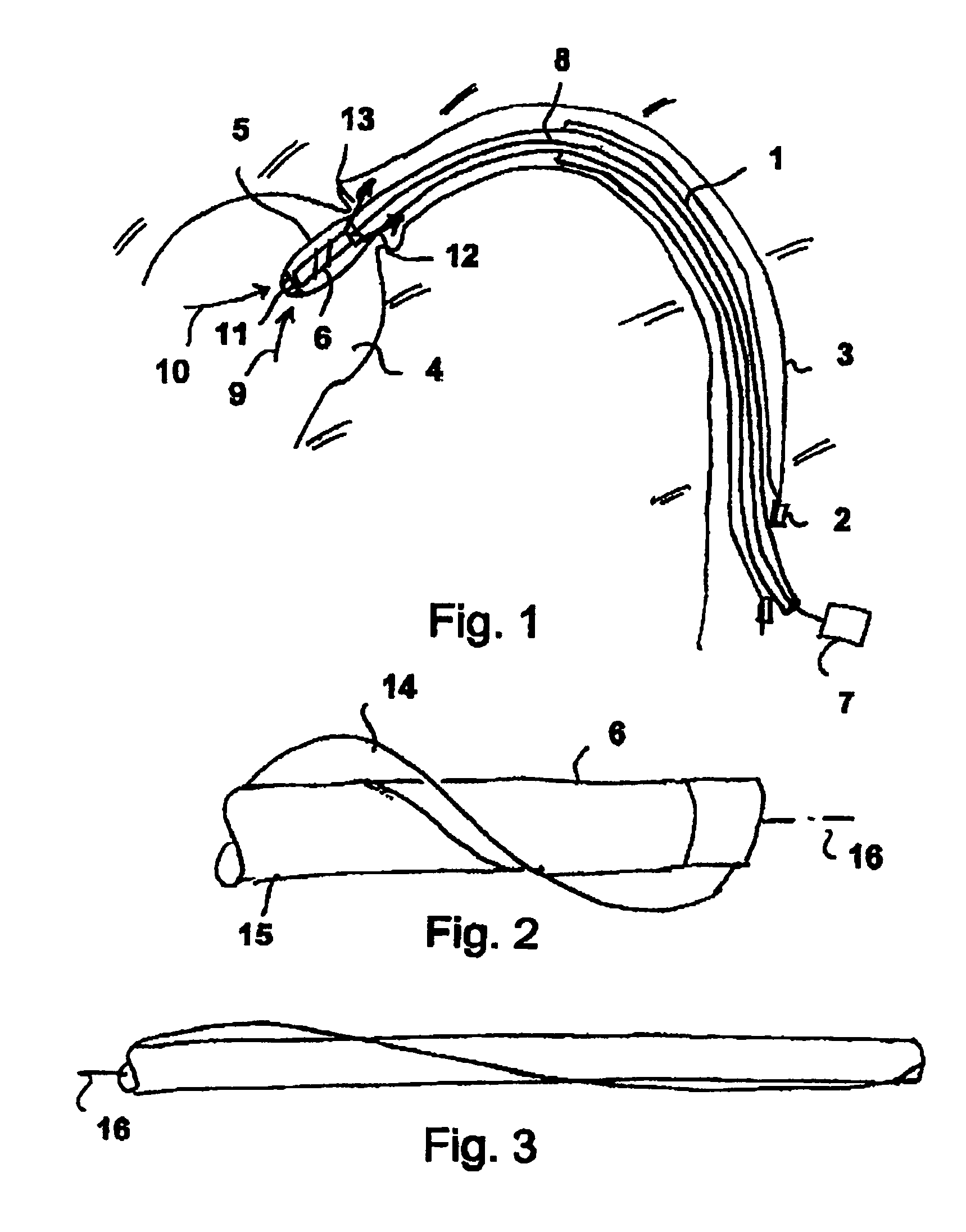 Fluid pump having a radially compressible rotor