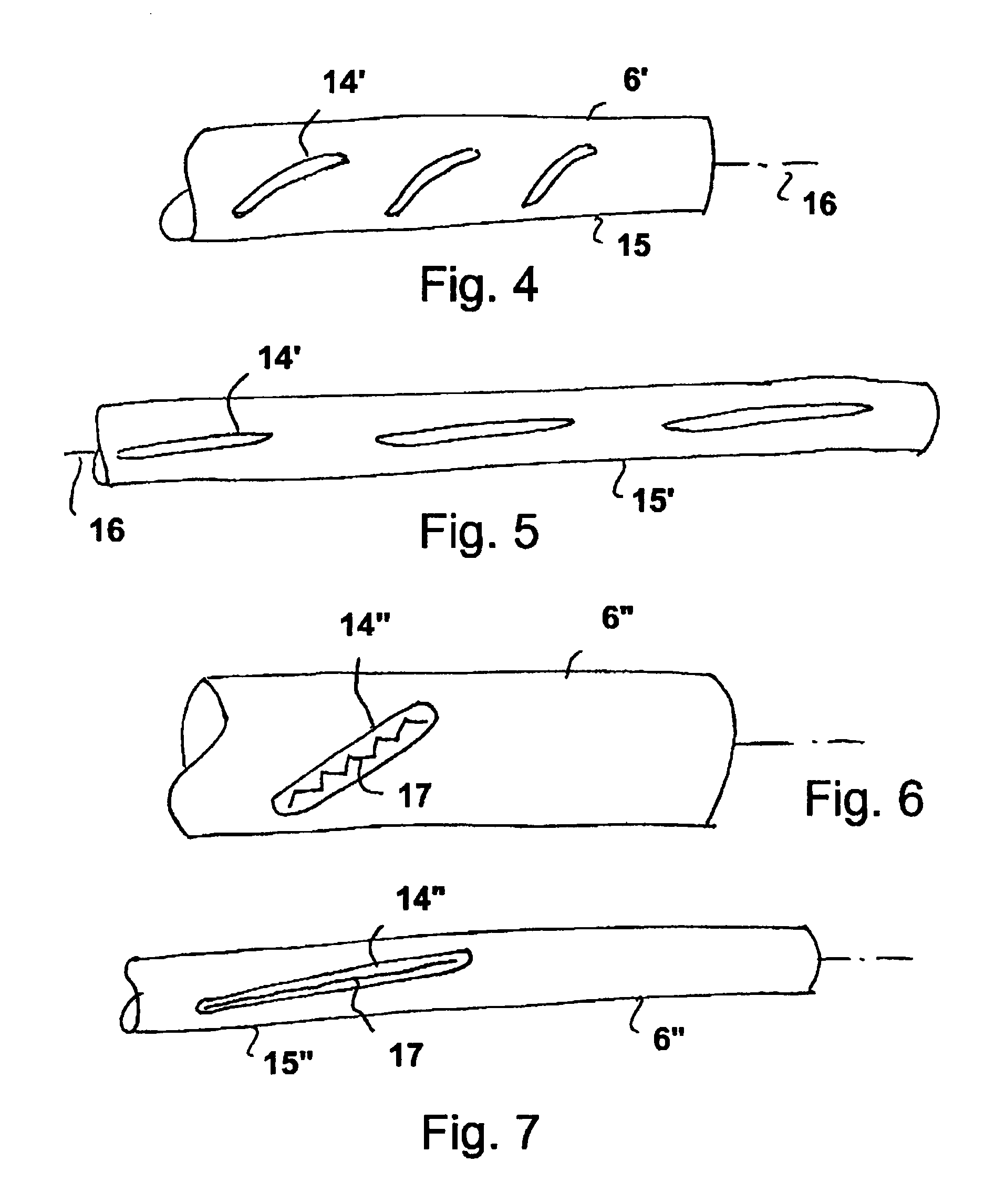 Fluid pump having a radially compressible rotor