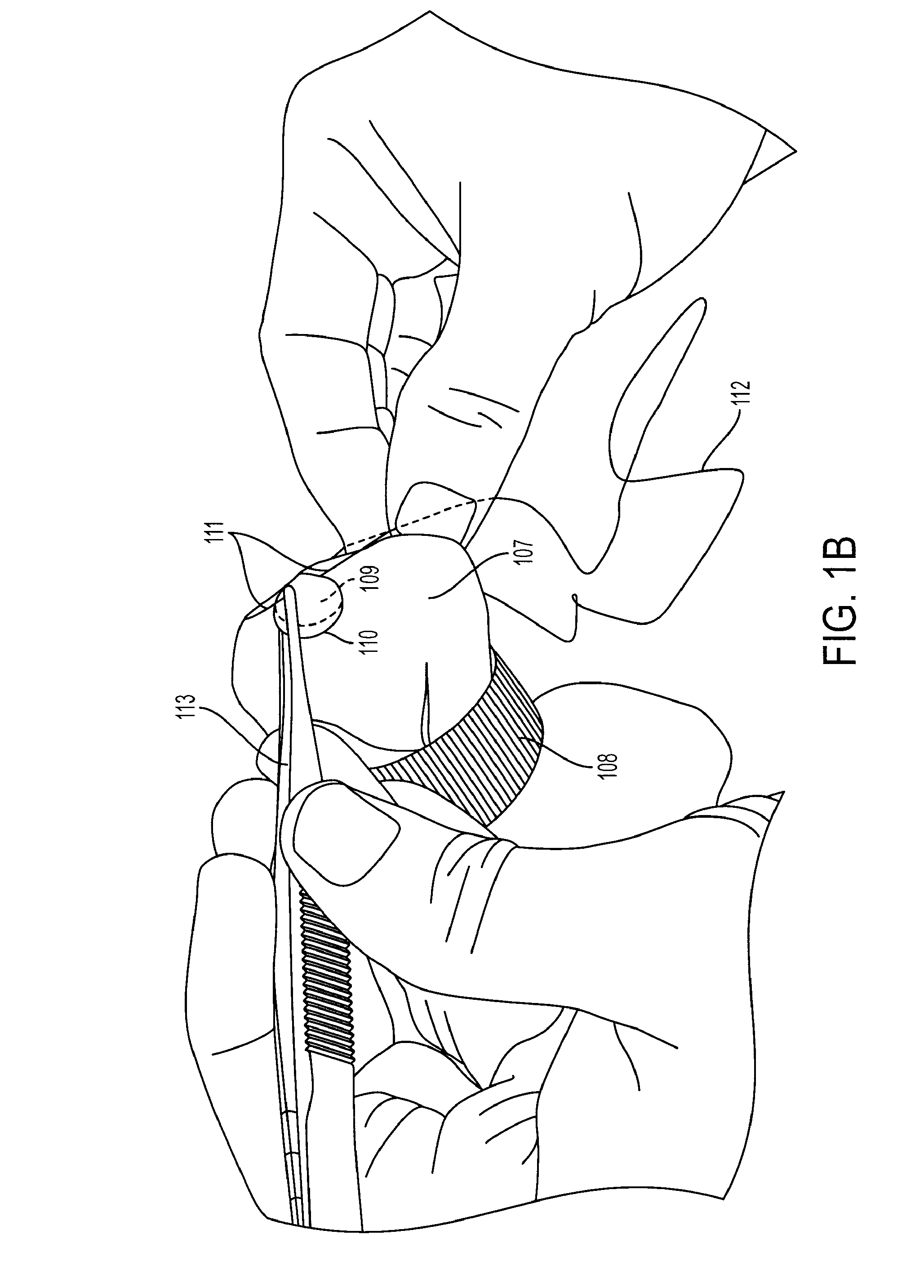 Apparatus, system, and method sewing