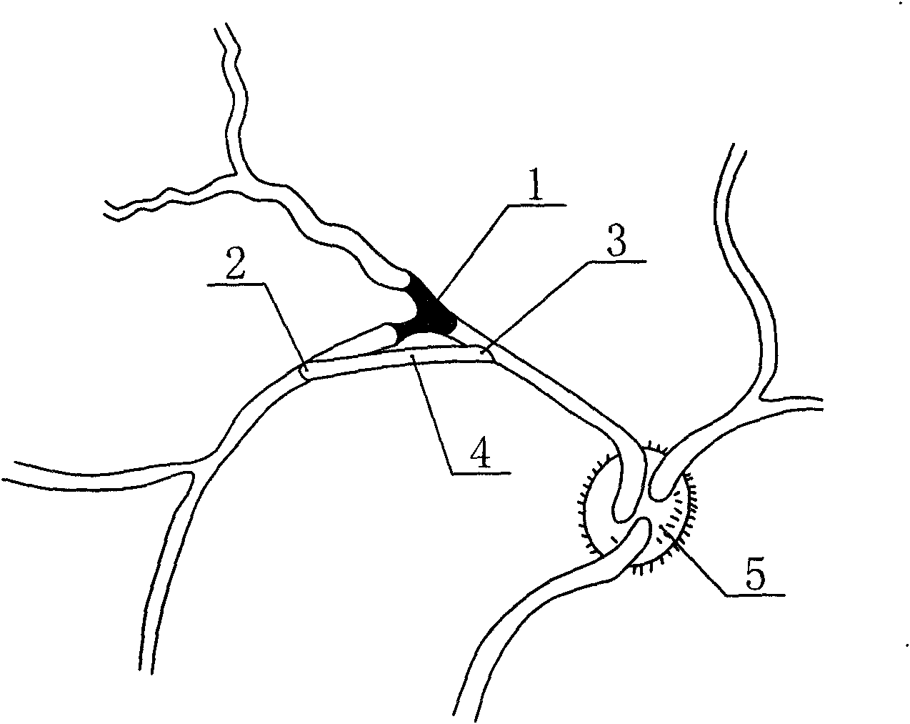 Method for preparing live animal eye model by retinal vein artificial blood vessel bypass operation