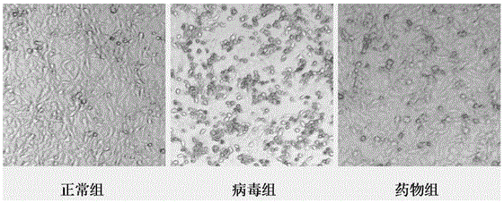 Compound phellinus igniarius medicine for treating hand-foot-and-mouth disease and preparation method thereof