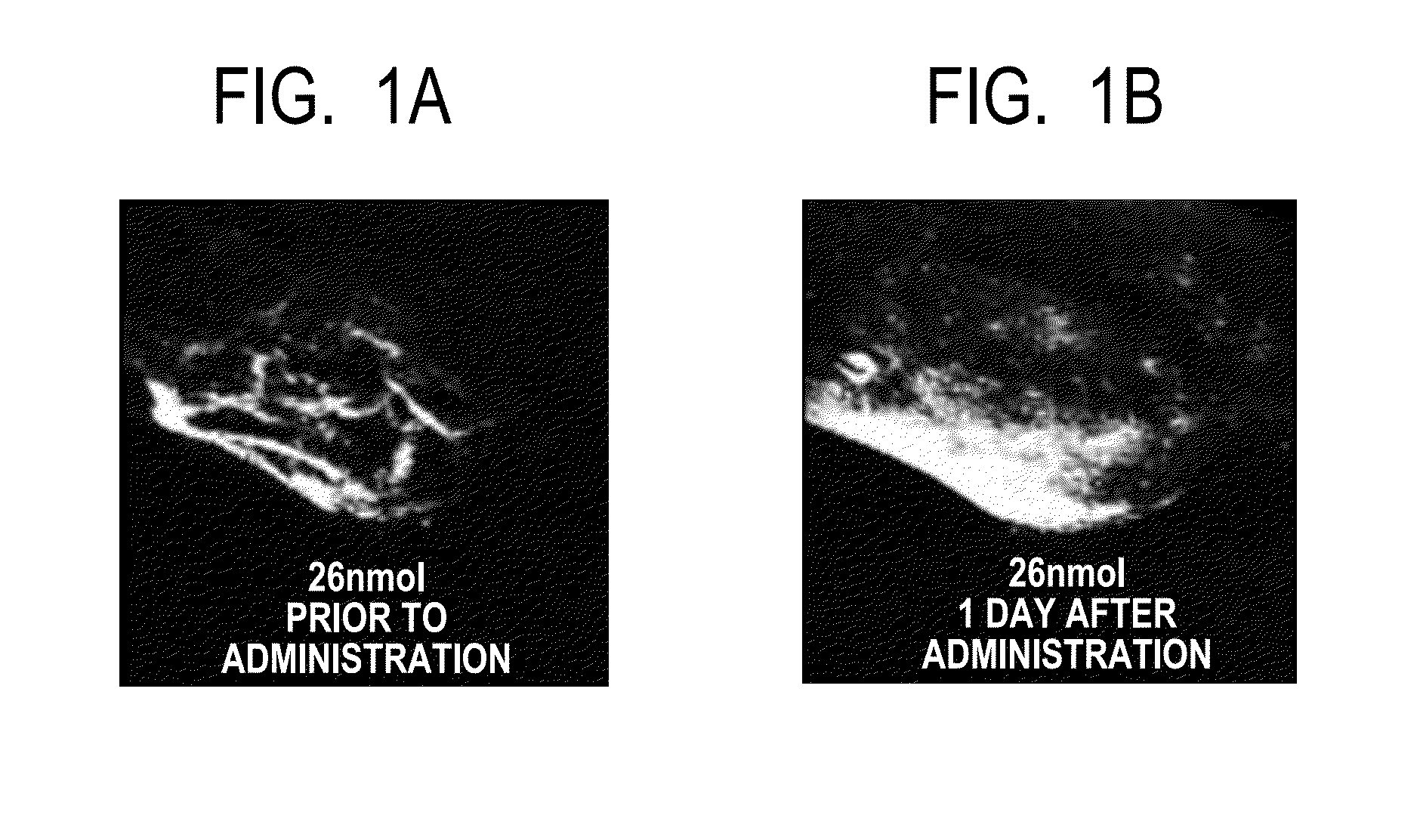 Dye-containing nanoparticle for photoacoustic contrast agent