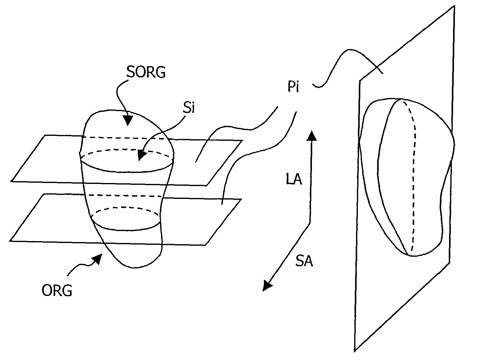 Method of following the three-dimensional deformation of a deformable organ