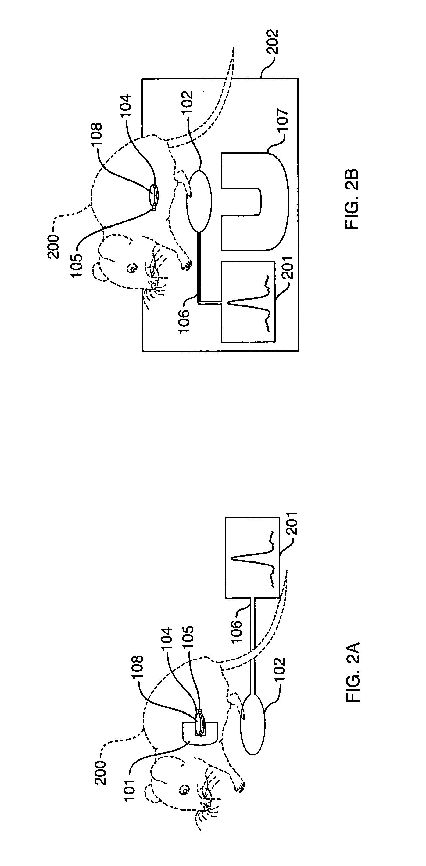Magnetic resonance system with implantable components and methods of use thereof