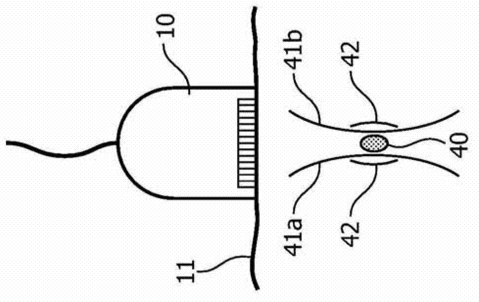 Adjusting measurements of the effects of acoustic radiation force for background motion effects