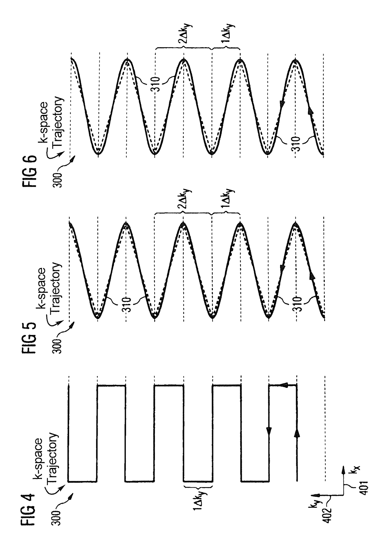 Method and magnetic resonance apparatus for echo planar imaging with data entry into k-space along a zigzag trajectory