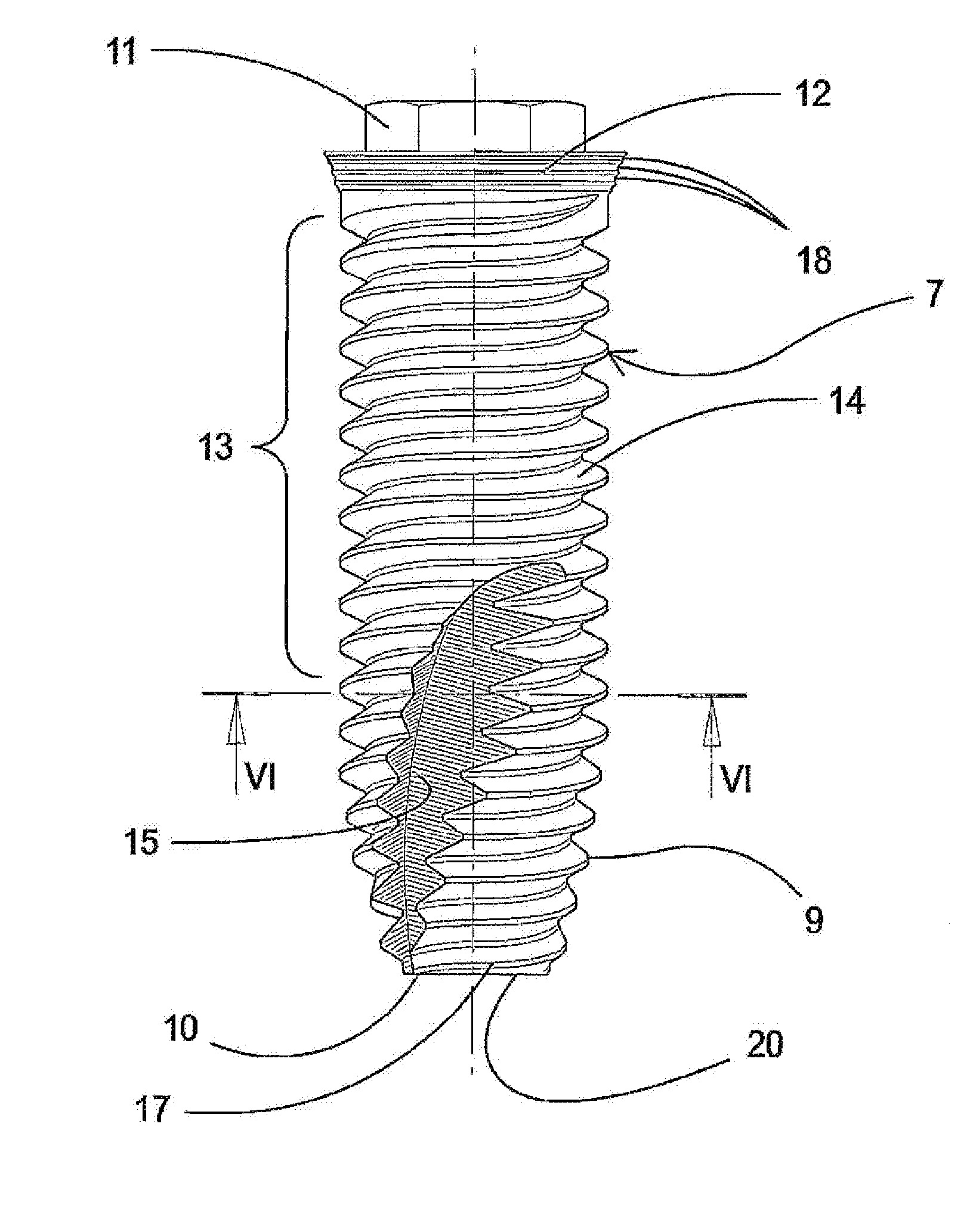 Endosseous implant of the improved type