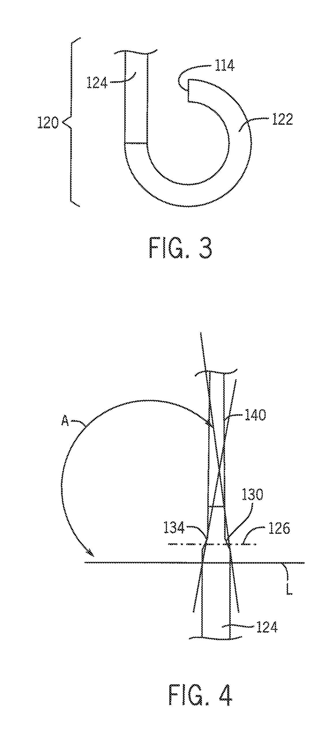 System and method for use of flexible anti-reflux ureteral stent