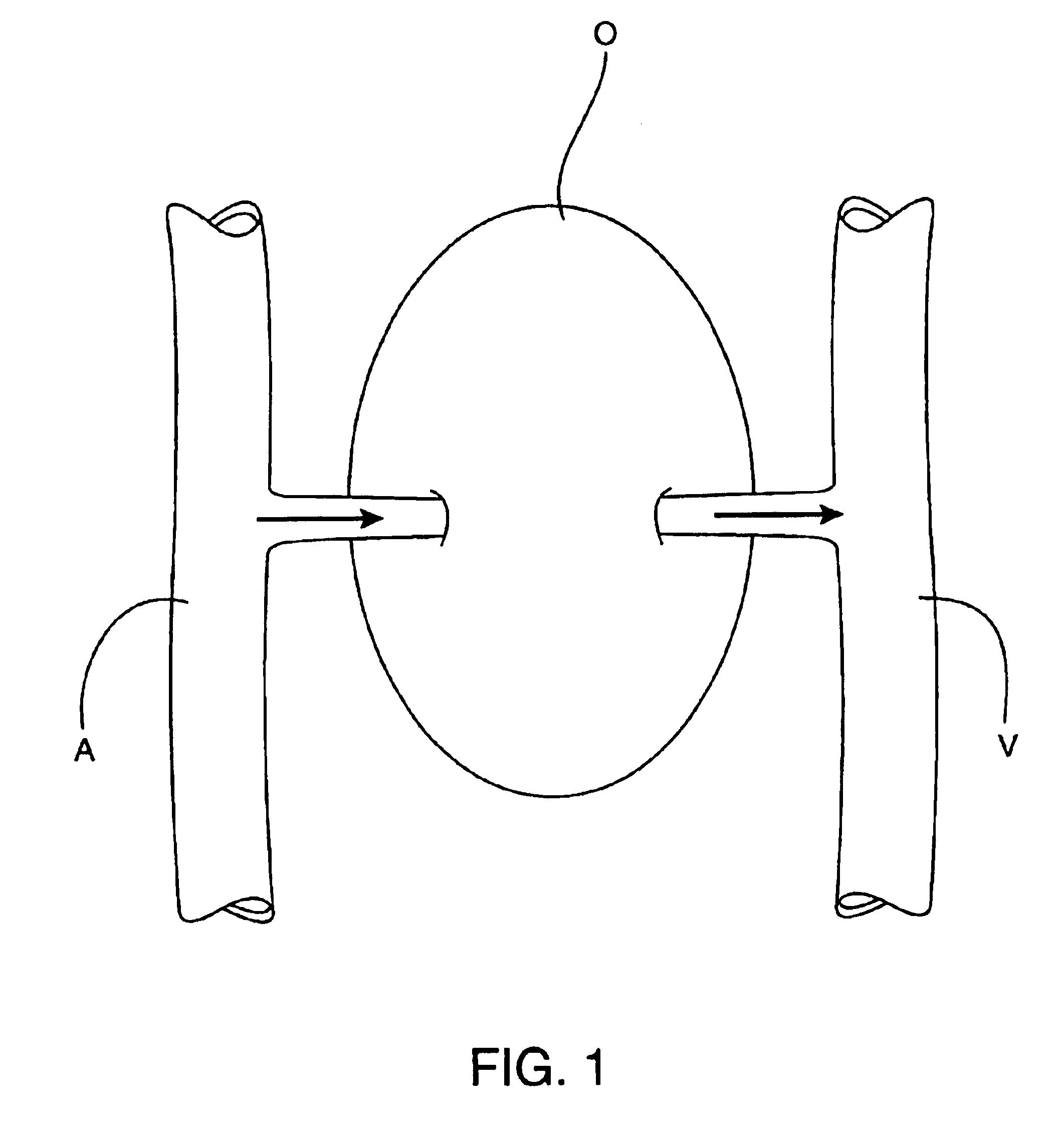 Methods and apparatus for perfusion of isolated tissue structure