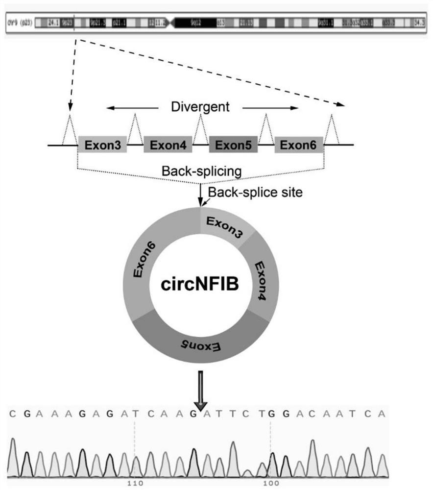 Application of circular RNA CircNFIB in diagnosis, treatment and prognosis of intrahepatic cholangiocellular carcinoma