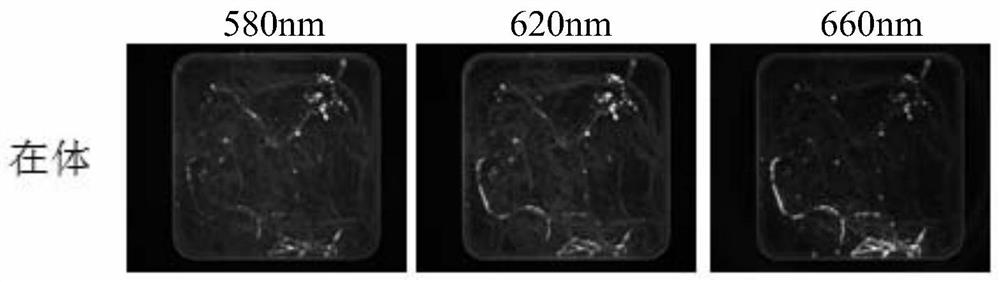 A Nodule Counting Method