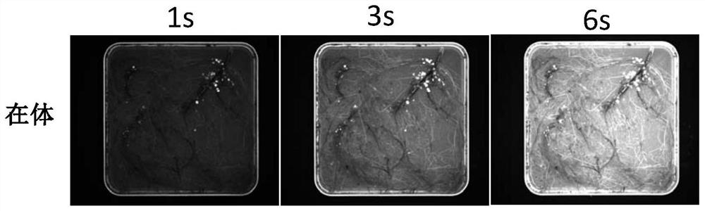 A Nodule Counting Method